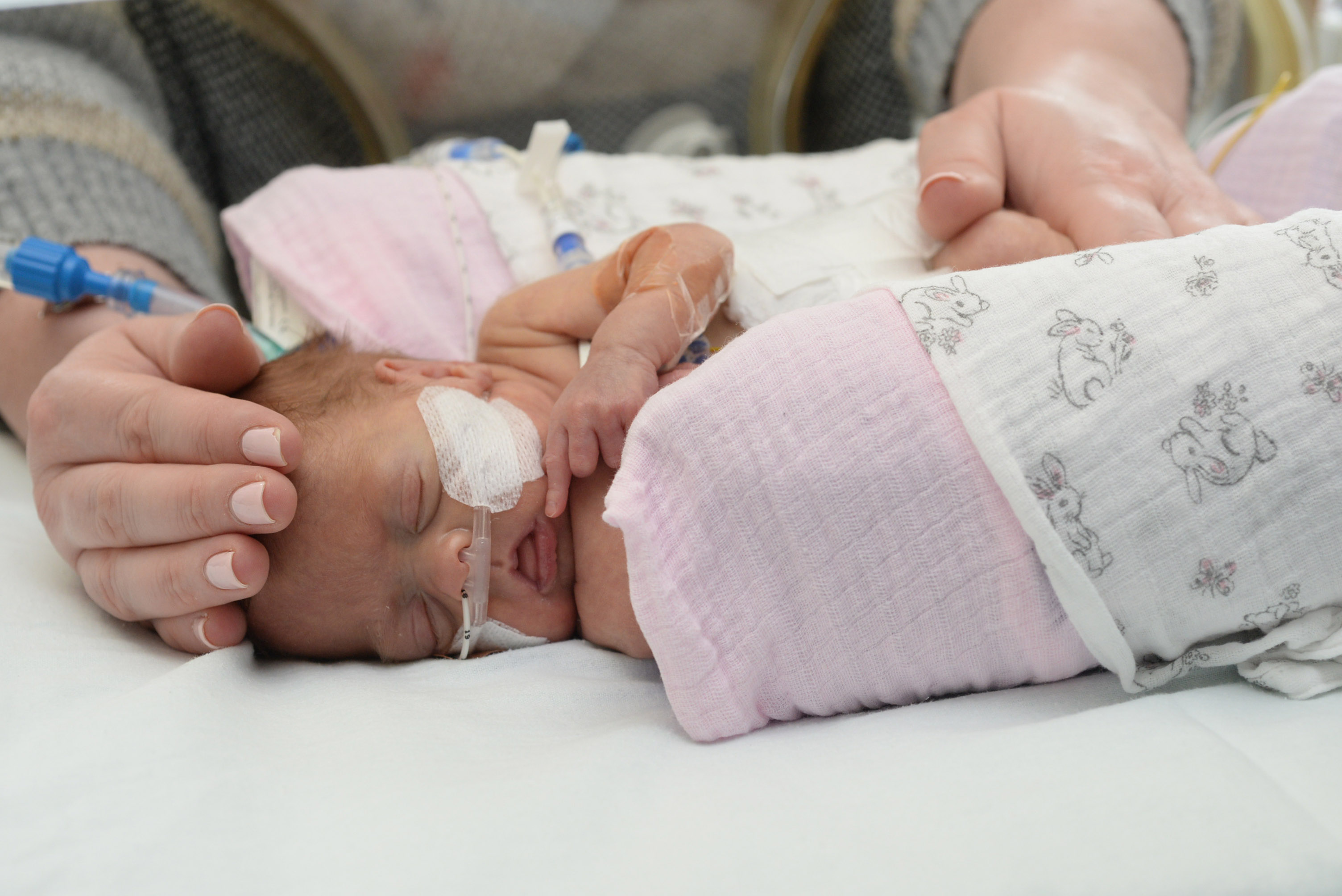 Developmentally Supportive Care & Early Intervention